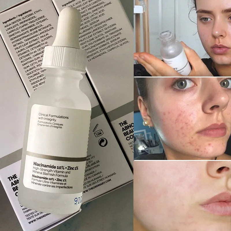 Niacinamide 10% + Zinc 1%