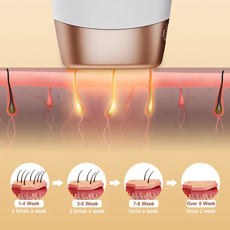 IPL Laser Epilator for Women