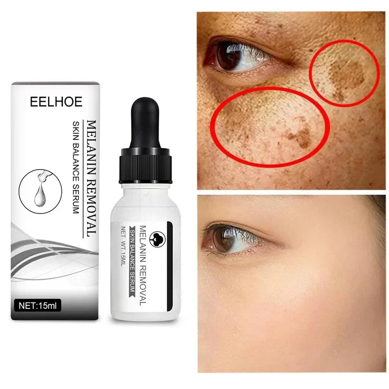 Niacinamide Serum Remove Dark Spots